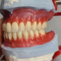 دندانسازی آرین ازکات