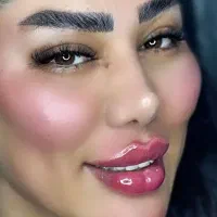 مادلینگ1500 بوتاکس250 تخفیف اخره هفته