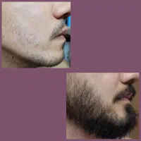 پشمام دیدی چی شد