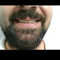 لابراتوار دندان مصنوعی