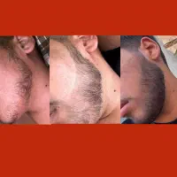پسرایی که ریش ندارن وقتشه