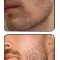 واقعا خسته نشدی از بی ریشی