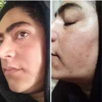 دقت کن فقط کرم ۸کاره فرانسوی بیومنتیک