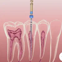 کلیه خدمات دندانپزشکی، بزرگسال و اطفال در لردگان