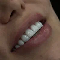 کامپوزیت‌/عصب کشی/دندانپزشکی اقساط ۱۲ ماهه