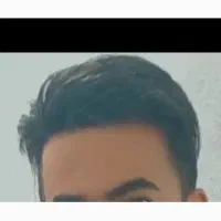 پروتز مو طبیعی مردانه