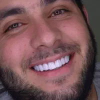 کامپوزیت عصبی کشی