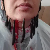 زالودرمانی وحجامت تخصصی