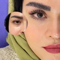 بلفاروپلاستی پلک ساکشن غبغب اتوپلاستی سانترال لب
