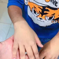 سفیدکننده پوست با پودر نانو،بااولین استفاده تضمینی