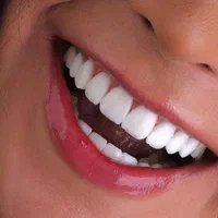 تمامی خدمات دندانپزشکی و کامپوزیت و فیسینگ