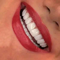کامپوزیت سرامیکی با ضمانت