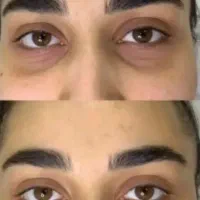 کرم ضد لک