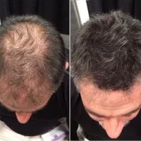 به جای اینکه مو بکاری این کارو بکن