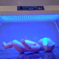 اجاره و کرایه دستگاه زردی