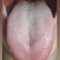 آموزش سونوگرافی کامل بدن از روی عکس زبان