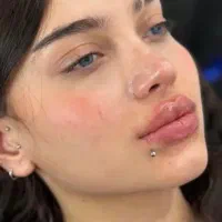 تخصص تزریقات ژل و بوتاکس و....