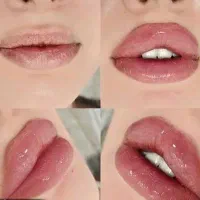 تخفیف بر روی تمامی تزریقات زیبایی ژل ،بوتاکس وغیره