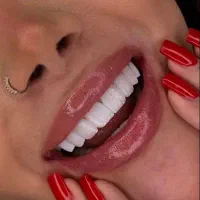 جشنواره ویژه کامپوزیت دندان از فکی ۳/۷۵۰
