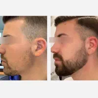 تا دیر نشده ریش وسبیل و موهاتو پس بگیر