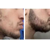 با ما صورتی زیبا برای خود رقم بزنید