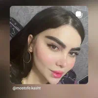 کاشت مو و ابرو