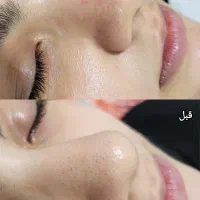 پاکسازی پوست