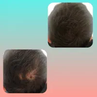 ریشات میشه اندازه موهات