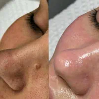 زیبایی|خدمات آرایشگری و زیبایی|قروه, |دیوار