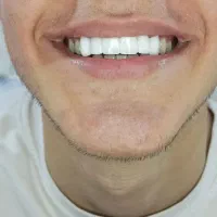 لابراتوار دندان سازی