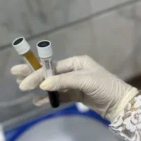 آف پی ار پی فقطط ۱۵۰۰ به مدت محدود