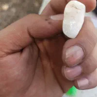 سنگ انگشتر