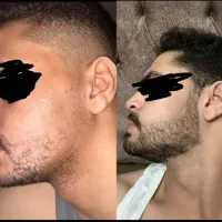 همه با این همه ریش بهت حسودی میکنند