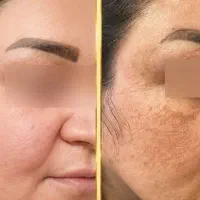 ویتابلا
