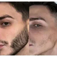 ریشات تضمینی پرپشت میشه