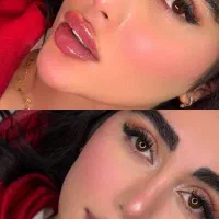 ژل لب فیلر لب مهرزاد نچرال