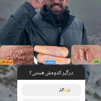 درمان زگیل و تبخال و پسوریازیس