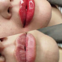 تخفیف ویژه شیدلب750،میکرو،فیبروز،خط چشم،آموزش تتو