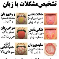 درمان کبد چرب اضافه وزن ومعده درد