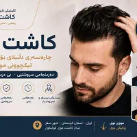 کاشت مو و ابرو