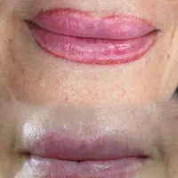 تکنسین تخصصی ریموو و ارایش دائم صورت