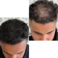 وقت تغییر و پرپشتی رسیده