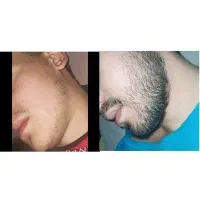ریشاتو تو خونه بکار