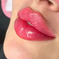 تخفیف فیلرتزریق پزشک/ژل/لب روسی،نخ،بوتاکس وفیلربدن