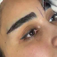 جشنواره اقساطی و تخفیف کاشت مو