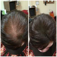 دیگر نگران دسته‌های مو روی برس نباش