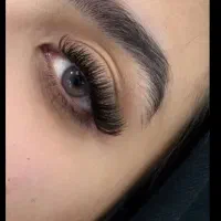 کاشت مژه
