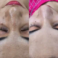 آف ۵۰ درصدی فیشیال کلاسیک