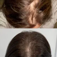 موهات را پر کن