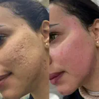 اف ویژه|خدمات زیبایی و سلامت|زابل, |دیوار